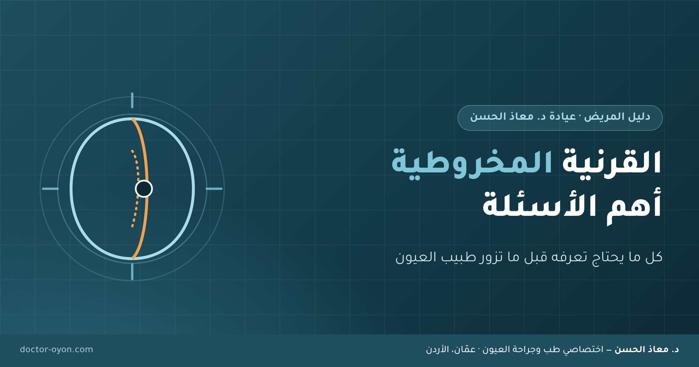 القرنية المخروطية أهم الأسئلة