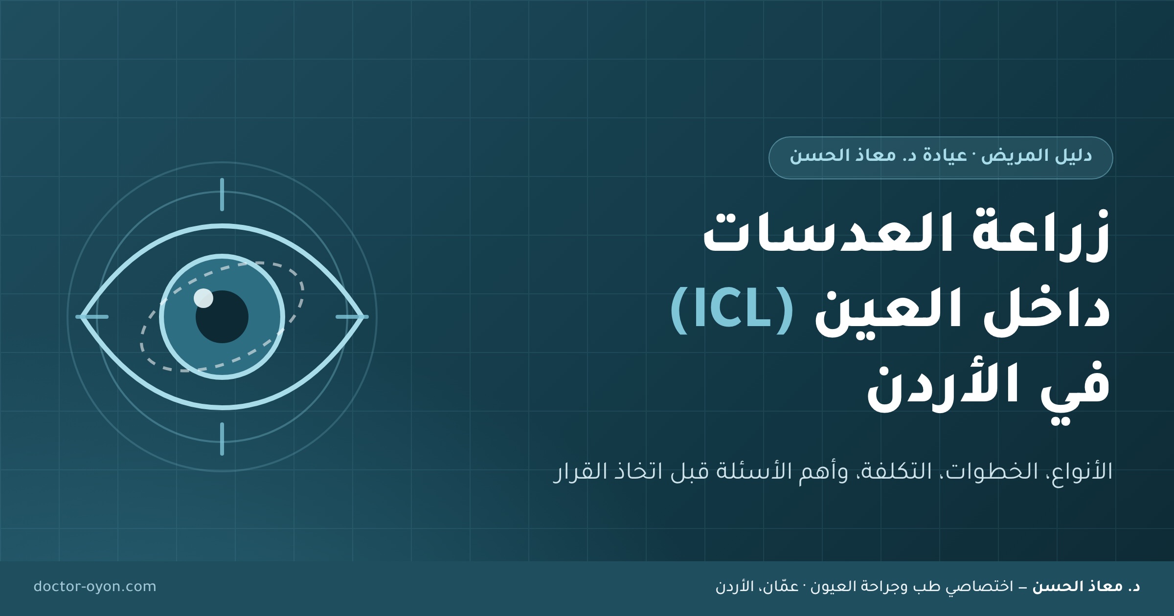 زراعة العدسات داخل العين ICL في الأردن