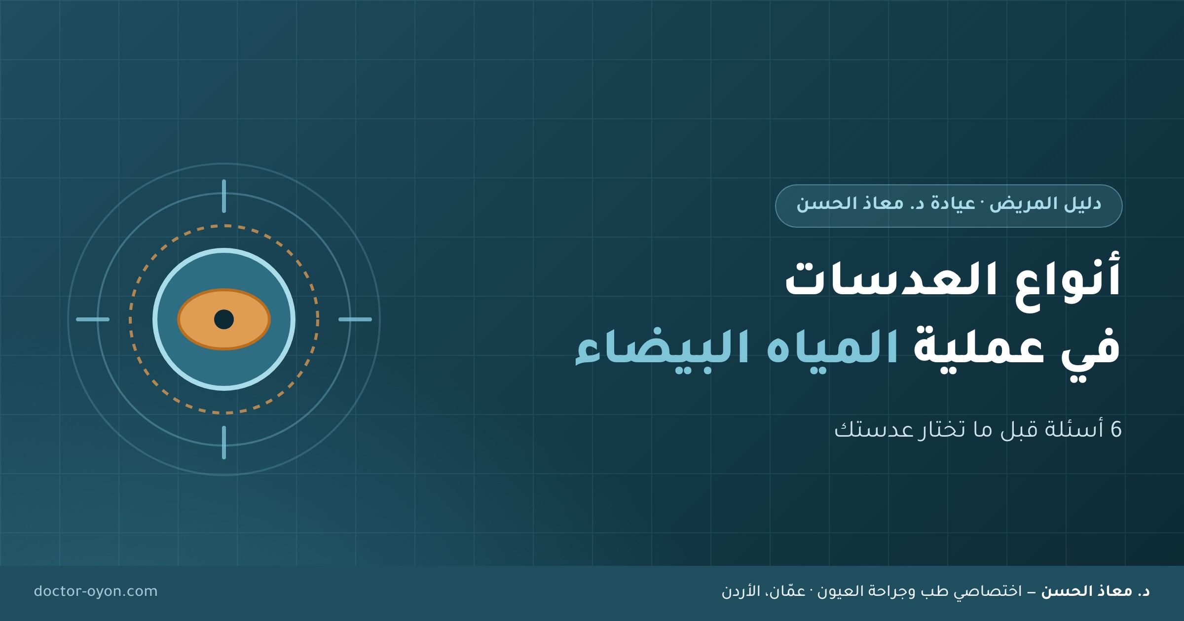 أنواع العدسات في عملية المياه البيضاء