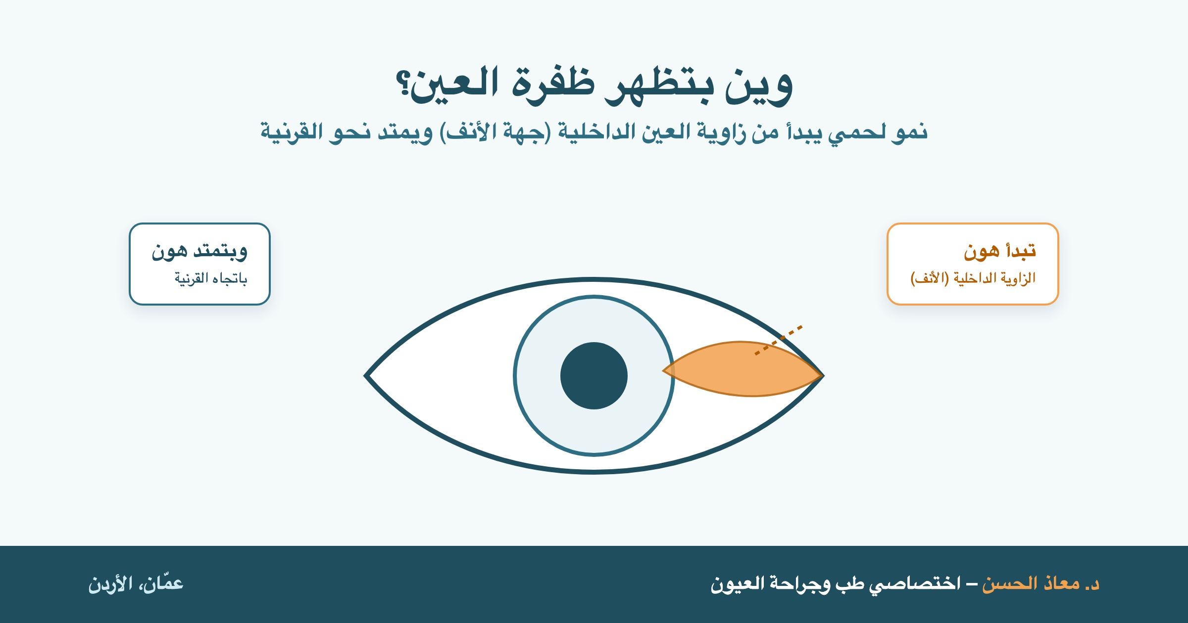 مكان ظهور ظفرة العين عند الزاوية الداخلية للعين